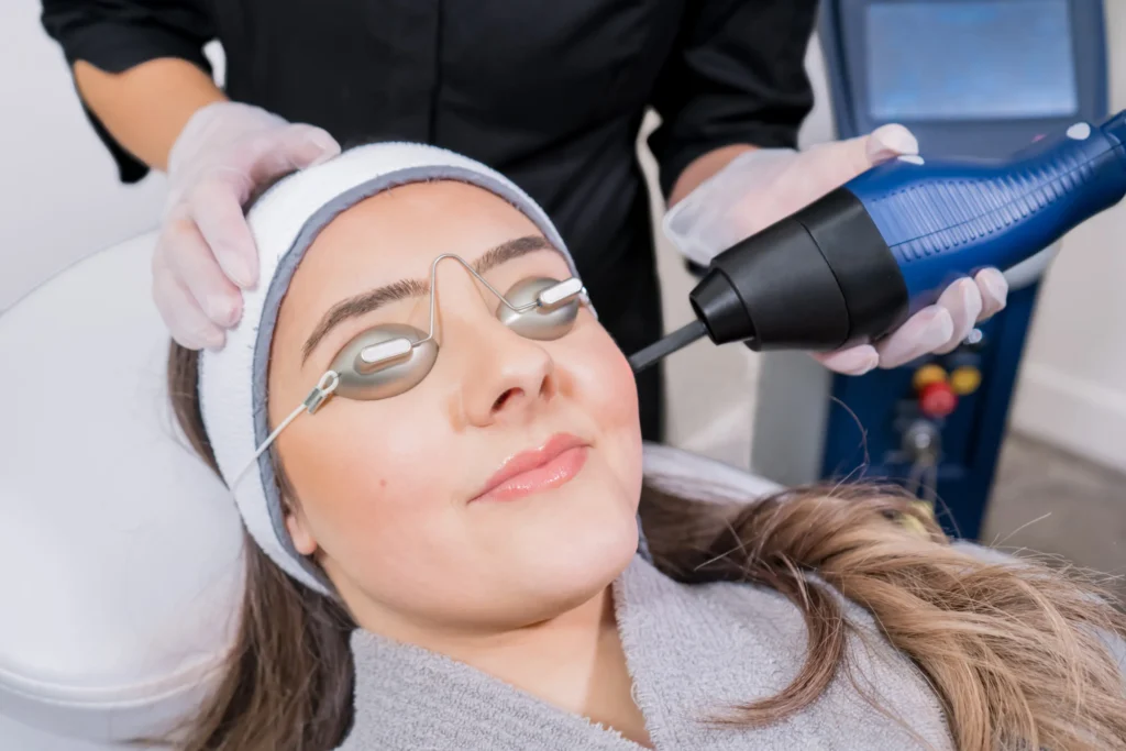 IPL Photofacial treatment in San Ramon, CA | Medspa CA