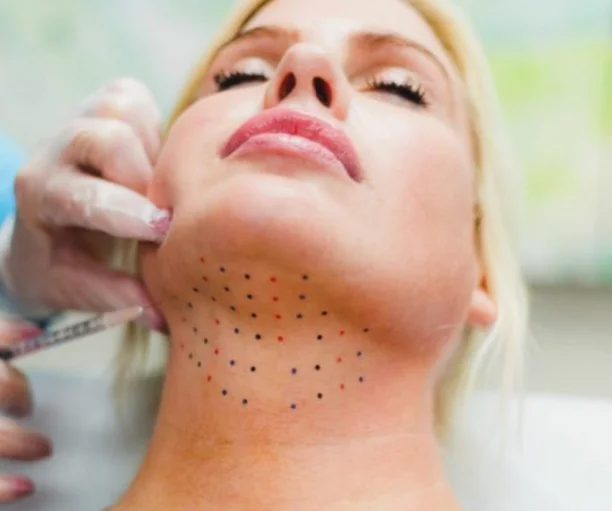 Keybella Injections in San Ramon, CA | Medspa CA