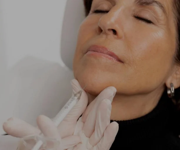 Radiesse filler Service in San Ramon, CA | Medspa