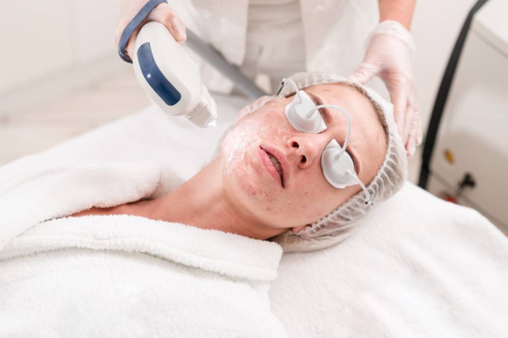 Laser Acne Treatment _ MedSpa California _ Ramon, CA